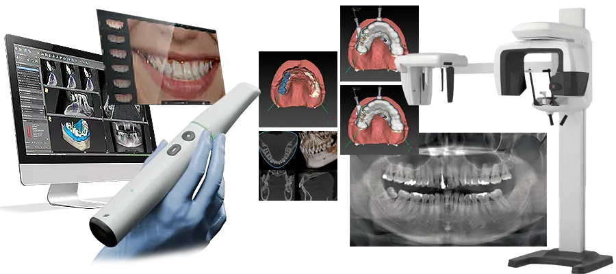 歯科用CT、口腔内スキャナー