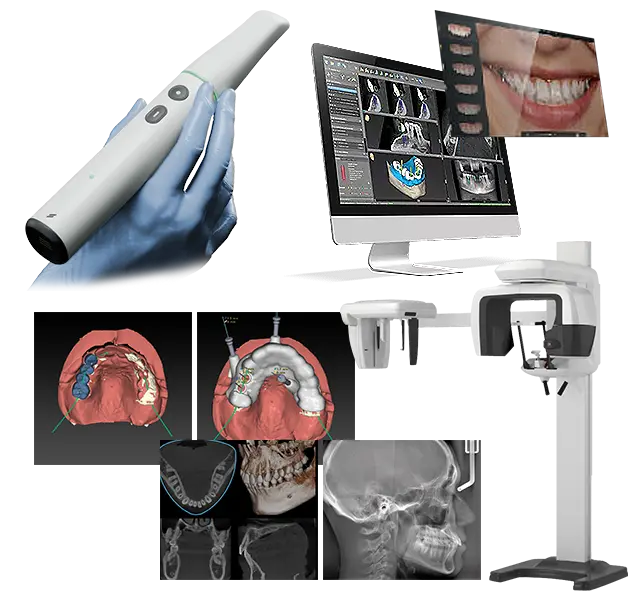 歯科用CT、口腔内スキャナー